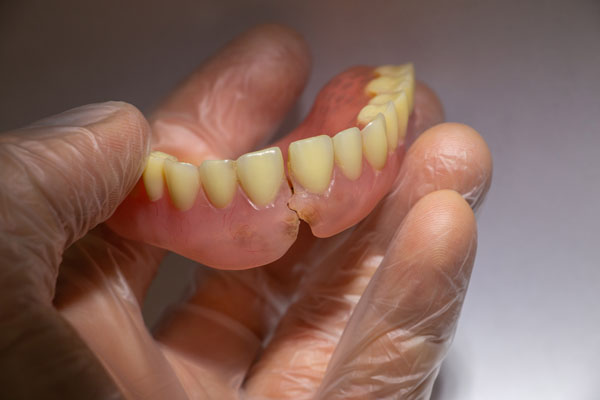 Denture Repairs For Broken Dentures